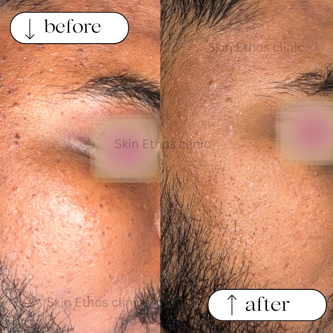 Treatment result photograph 1