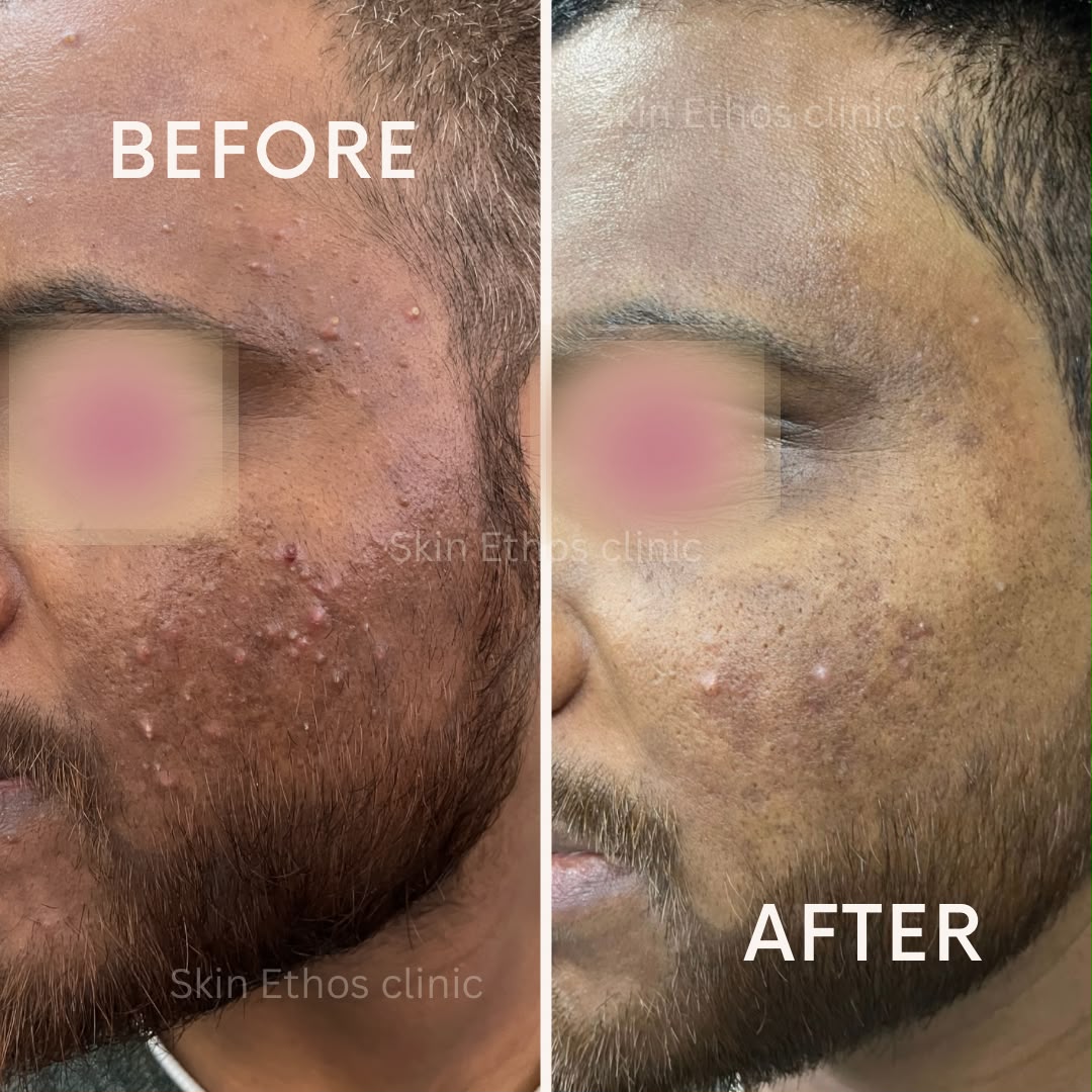 Treatment result photograph 2