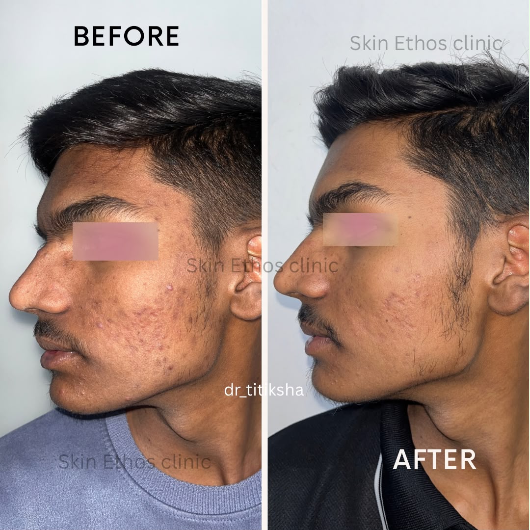 Treatment result photograph 3