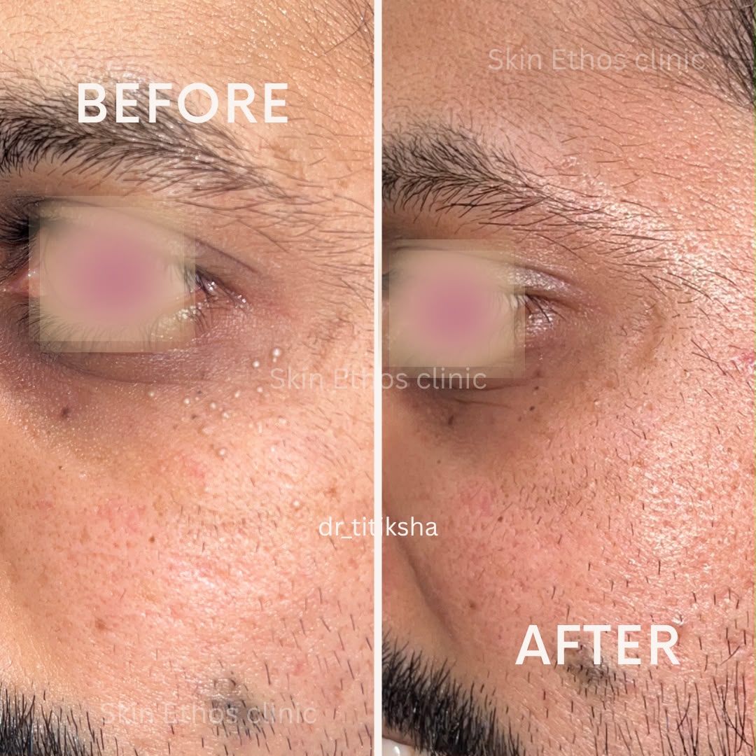 Treatment result photograph 4