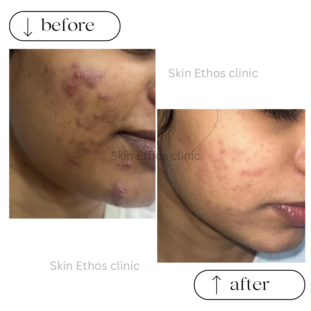 Treatment result photograph 5
