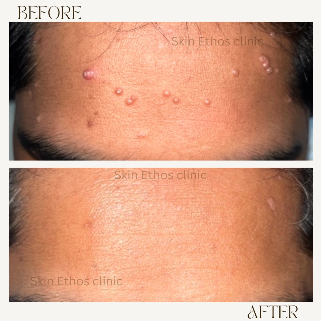 Treatment result photograph 6