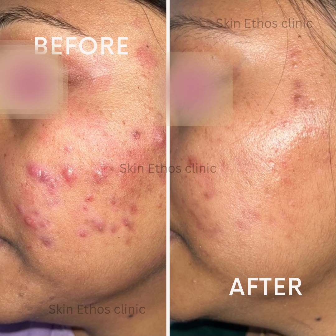 Treatment result photograph 7