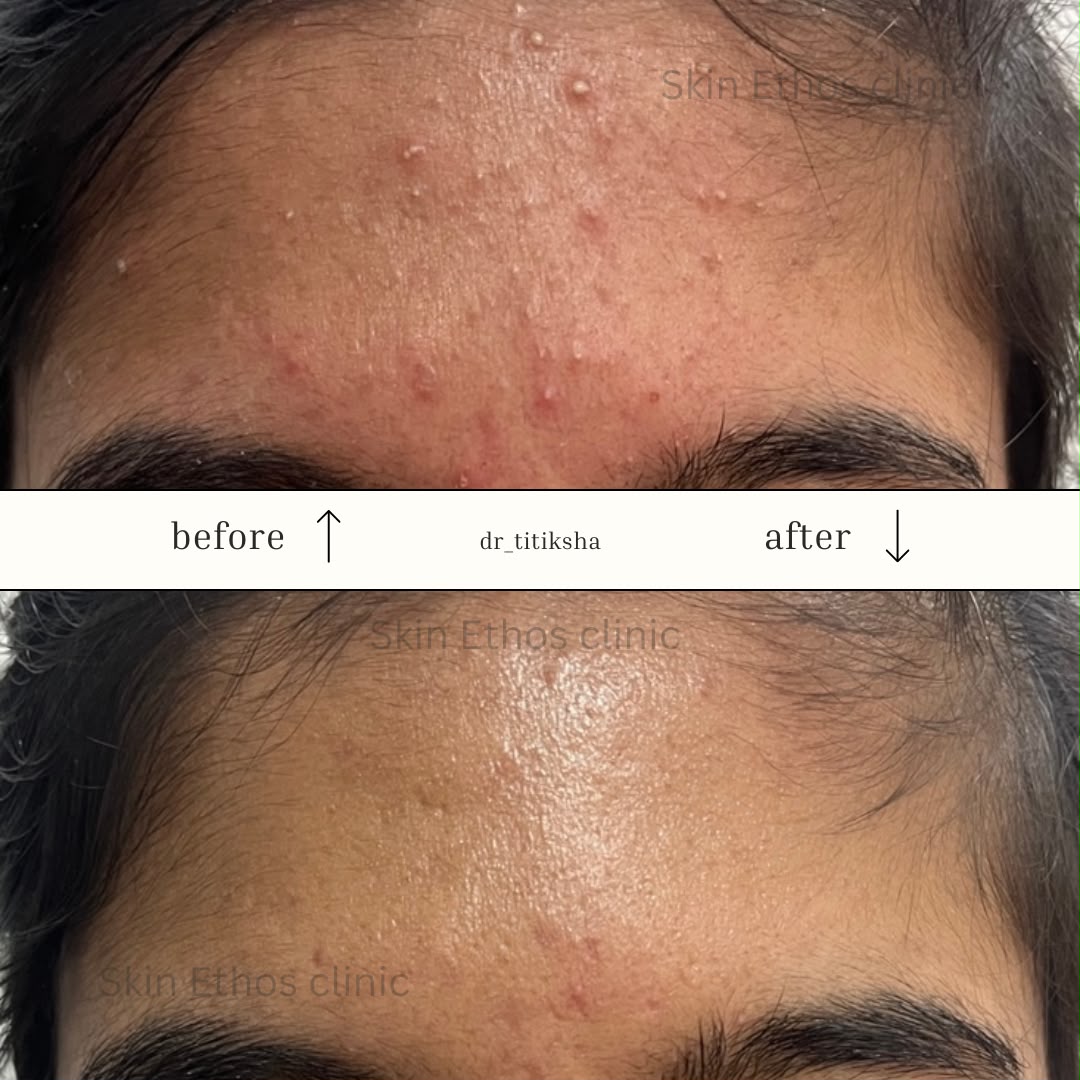 Treatment result photograph 8