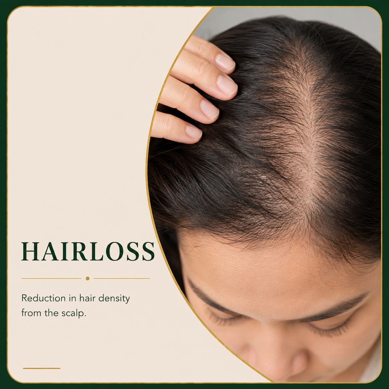 Hair loss and thinning — Skin Ethos Clinic